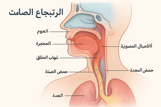 الارتجاع الصامت